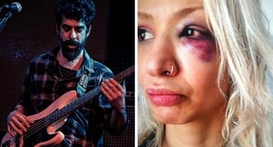 Ünlü gitaristinin sevgilisinden şiddet iddiası