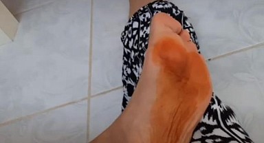 Kına tıbben de şifa kaynağı!