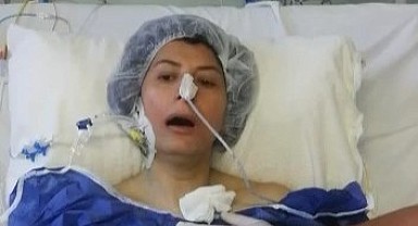 Akciğer nakli olan hasta yıllar sonra nefes aldı!