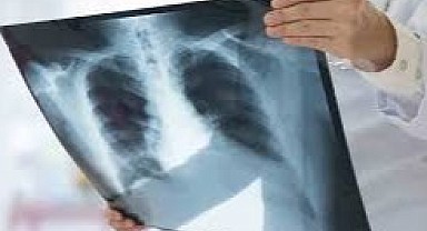 Zatürre ciddi sonuçlara neden olabiliyor