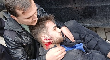Beylikbağı'nda katliam gibi kaza! Ağır yaralı var