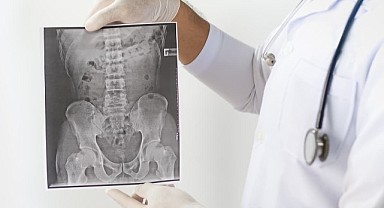 Ankilozan Spondilit ile de dolu dolu yaşamak mümkün