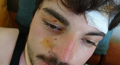 Oyuncu Akdeniz’i darp eden 2 kişi gözaltına alındı