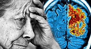 Bu buluş Alzheimer'a umut olacak!