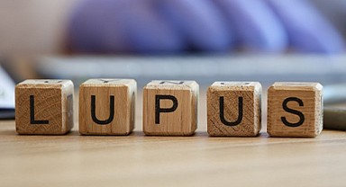 Yüzünüzdeki lekelere dikkat! Lupus olabilir