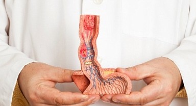 Yemek borusu kanserinin 6 belirtisine dikkat! 