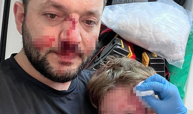 Kucağındaki bebeğiyle saldırıya uğradı!