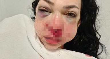 Anne ve oğlunu darp etmişlerdi! 1 kişi tutuklandı