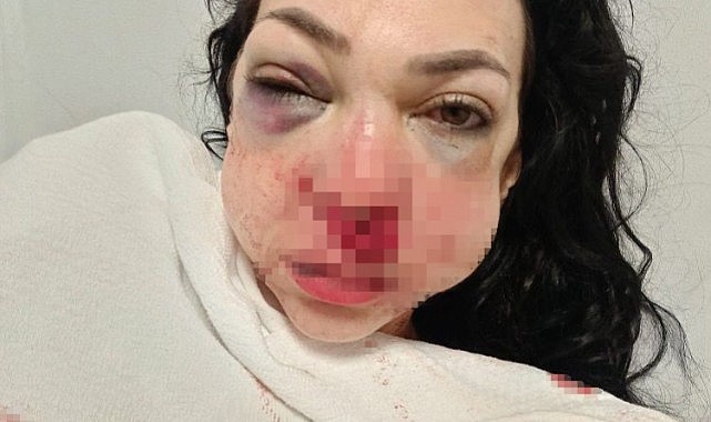 Anne ve oğlunu darp etmişlerdi! 1 kişi tutuklandı