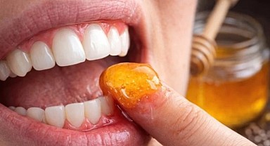 Diş eti için doğal çözüm