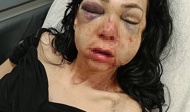 Küfür etmeyin dediler! Tekme tokat dayak yediler