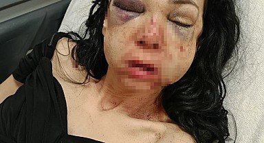Anne ve oğlunu darp etmişlerdi! Medivenden düştü dediler