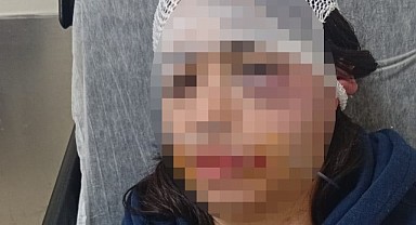Ayrıldı diye kız arkadaşını darp etmişti! 