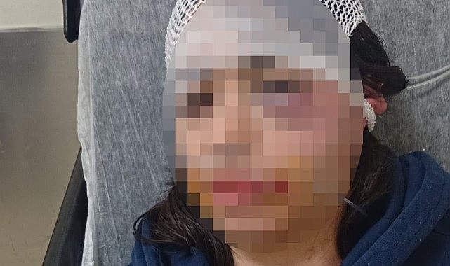 Ayrıldı diye kız arkadaşını darp etmişti!